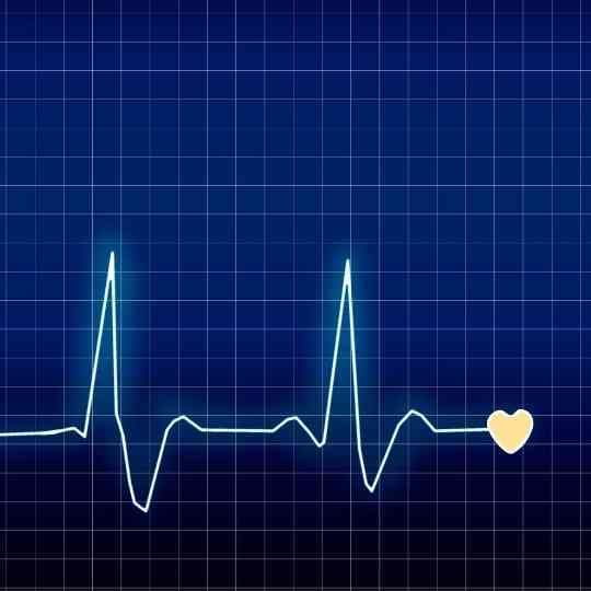 ECG