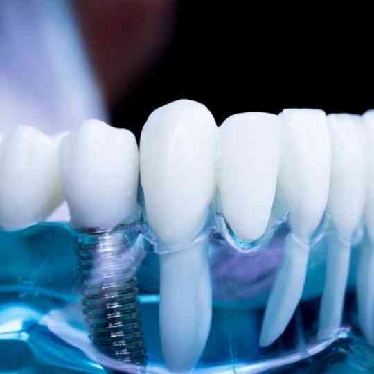 L'imagerie Cone Beam dans les soins dentaires